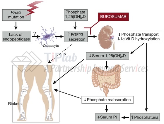 参见:Kidney Int. 2018 Nov;94(5):846-848.